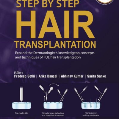 STEP BY STEP HAIR TRANSPLANTATION