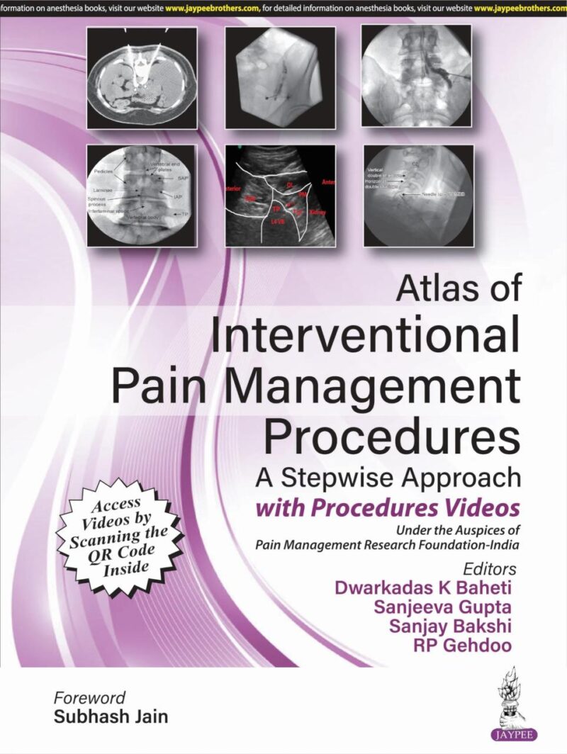 Atlas of Interventional Pain Management Procedures: A Stepwise Approach