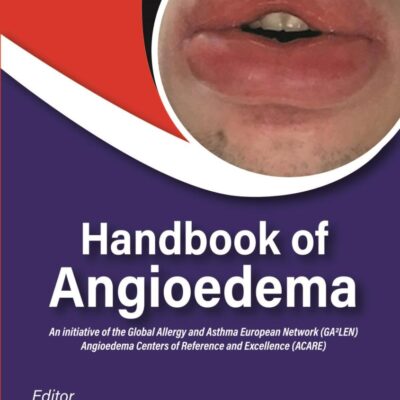 Handbook of Angioedema