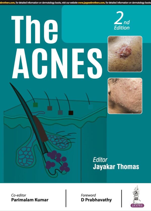 THE ACNES