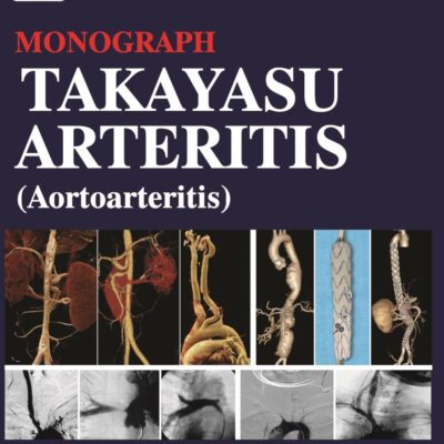 CSI Monograph Takayasu Arteritis (Aortoarteritis)