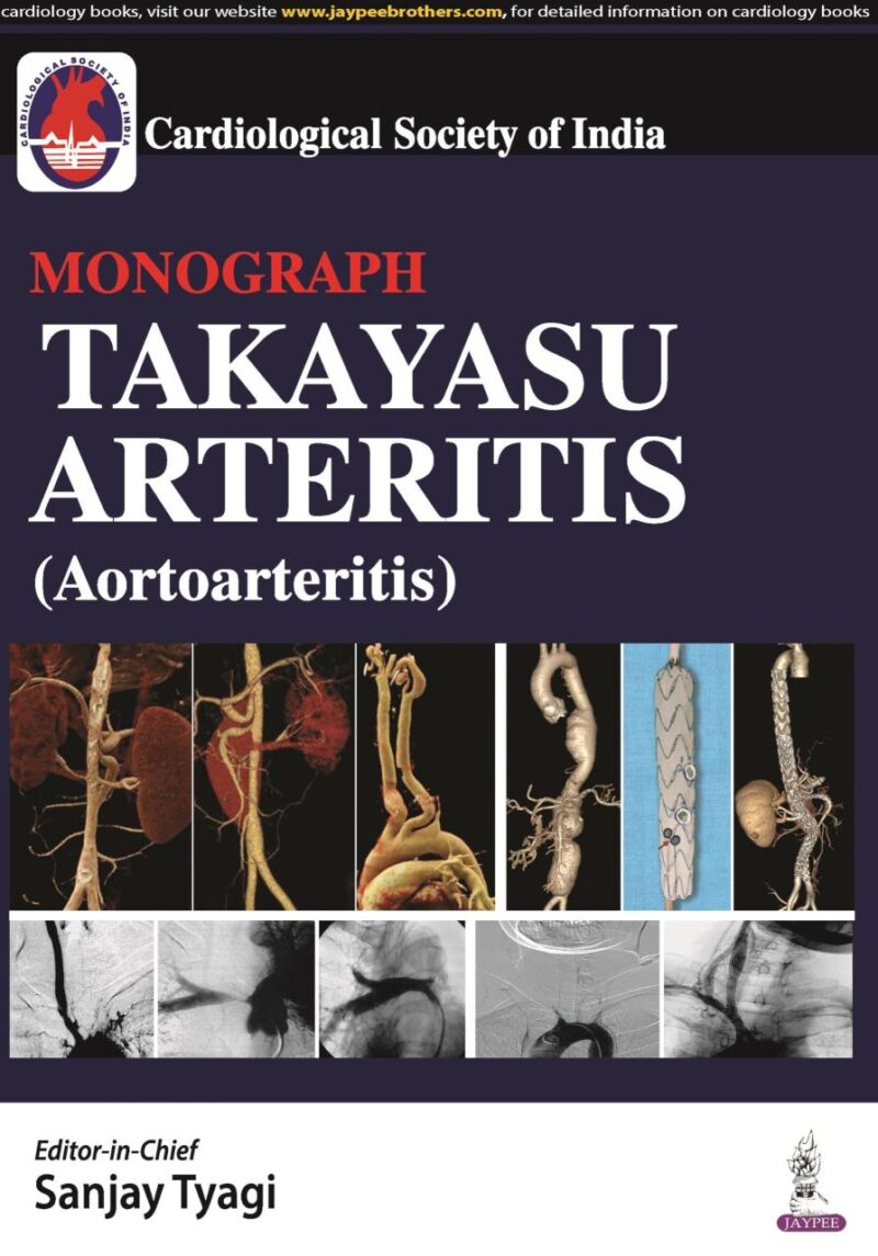 CSI Monograph Takayasu Arteritis (Aortoarteritis)