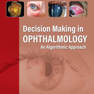 Decision Making in Ophthalmology: An Algorithmic Approach