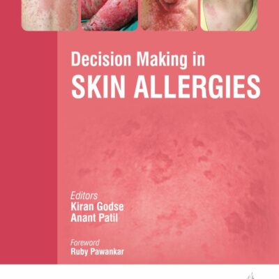 DECISION MAKING IN SKIN ALLERGIES