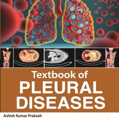 Textbook of Pleural Diseases