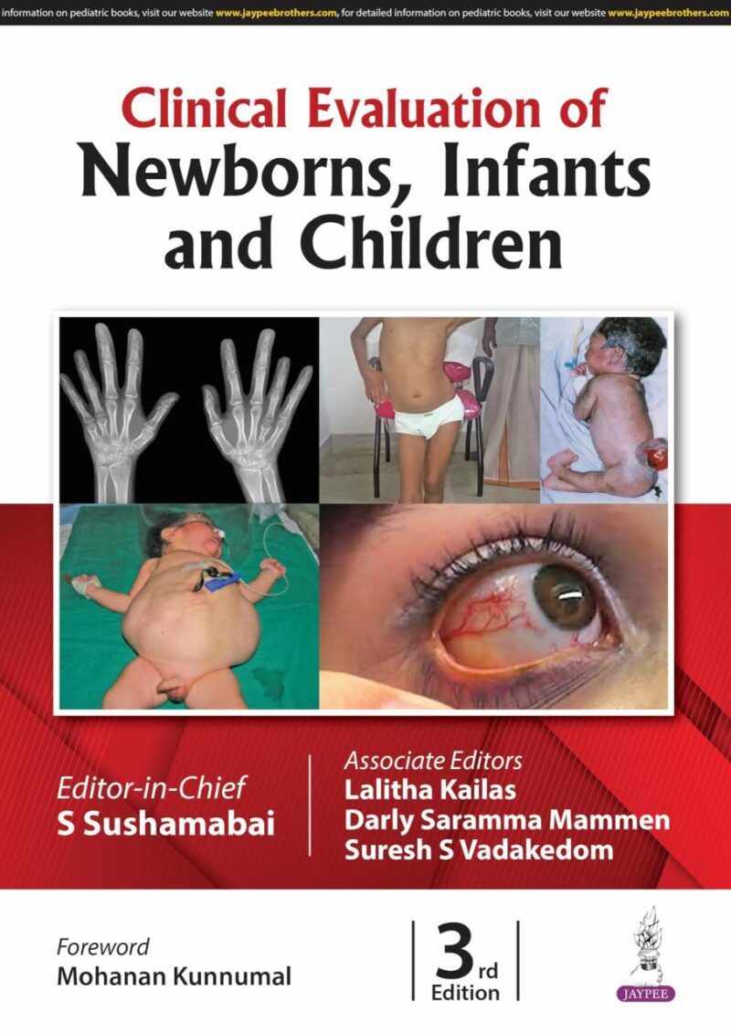 CLINICAL EVALUATION OF NEWBORNS