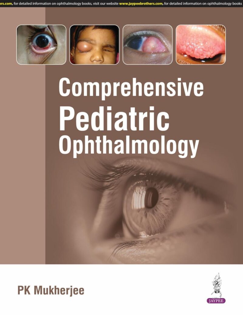 COMPREHENSIVE PEDIATRIC OPHTHALMOLOGY