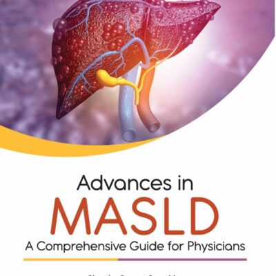 ADVANCES IN MASLD : A COMPREHENSIVE GUIDE FOR PHYSICIANS