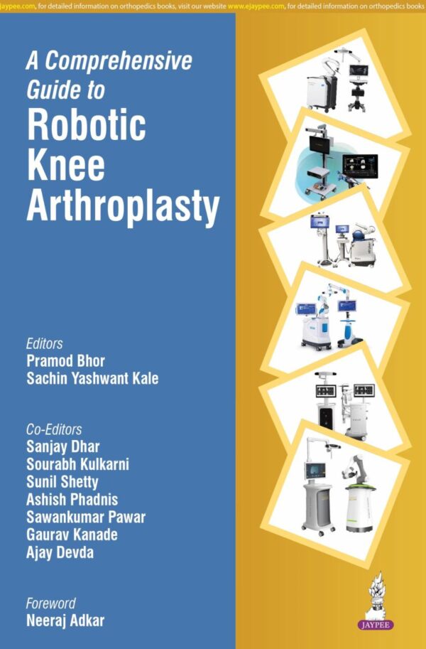 A COMPREHENSIVE GUIDE TO ROBOTIC KNEE ARTHROPLASTY