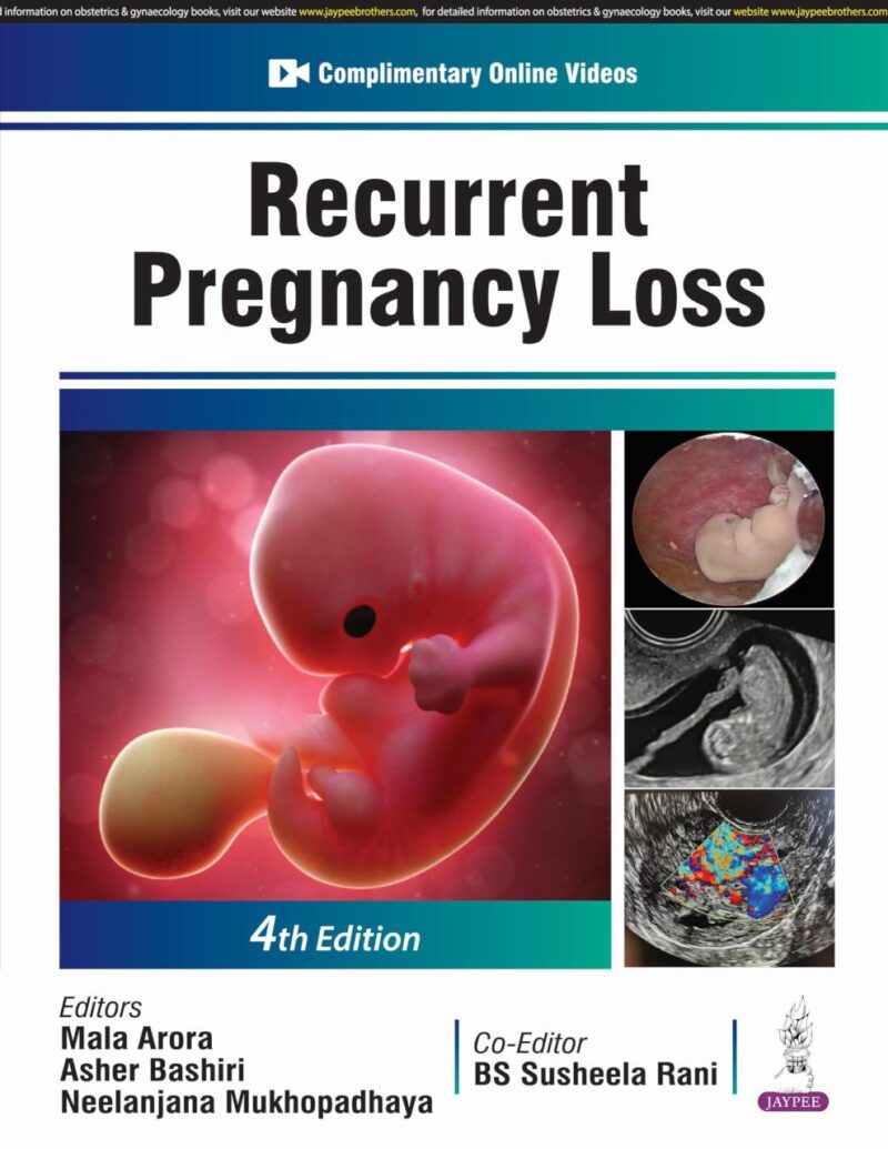 RECURRENT PREGNANCY LOSS