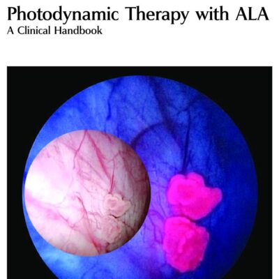 PHOTODYNAMIC THERAPY WITH ALA: A CLINICAL HANDBOOK: Volume 7 (Comprehensive Series in Photochemical & Photobiological Sciences)