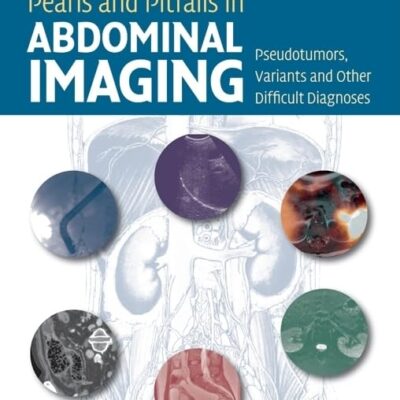 Pearls and Pitfalls in Abdominal Imaging: Pseudotumors