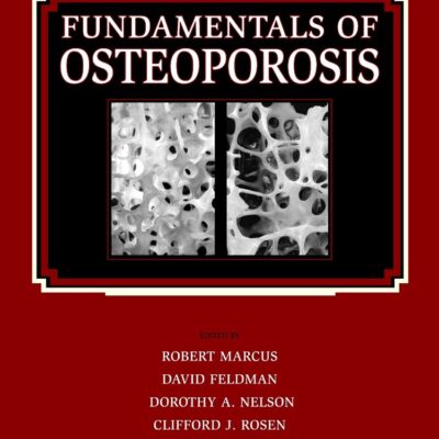 Fundamentals of Osteoporosis