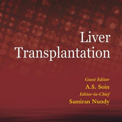 Liver Transplantation - ECAB