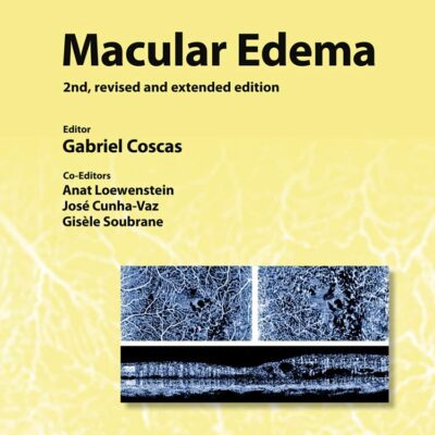 Macular Edema (Developments in Ophthalmology)