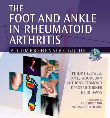 The Foot and Ankle in Rheumatoid Arthritis: A Comprehensive Guide