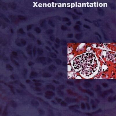 Xenotransplantation