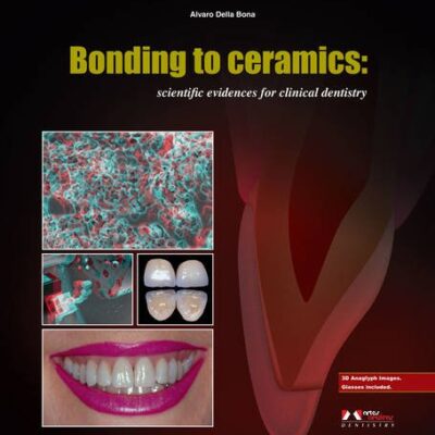 Bonding to Ceramics: Scientific Evidences for Clinical Dentistry
