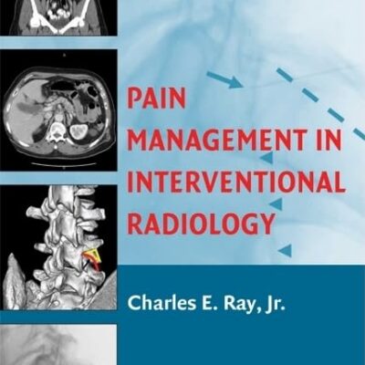 Pain Management in Interventional Radiology