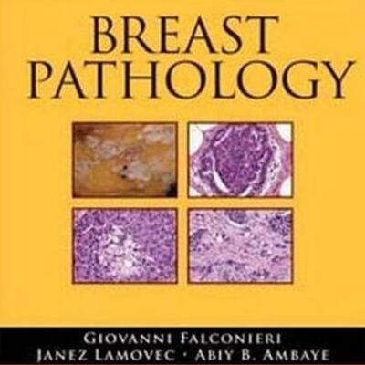 Breast Pathology (Demos Surgical Pathology Guides)