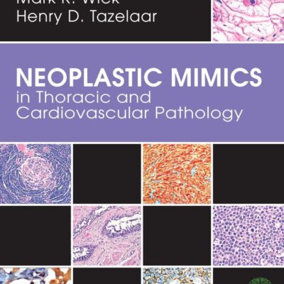 Neoplastic Mimics in Thoracic and Cardiovascular Pathology (Pathology of Neoplastic Mimics)