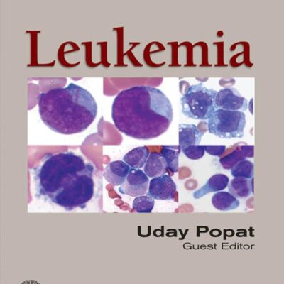 Leukemia (Emerging Cancer Therapeutics