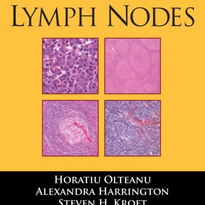 Lymph Nodes (Demos Surgical Pathology Guides)
