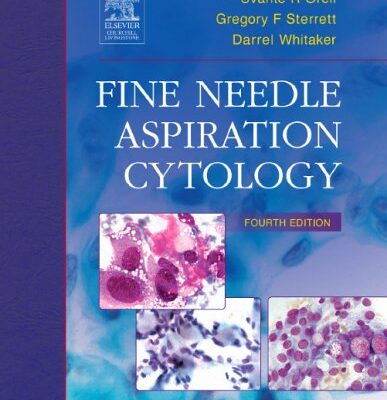 Fine Needle Aspiration Cytology