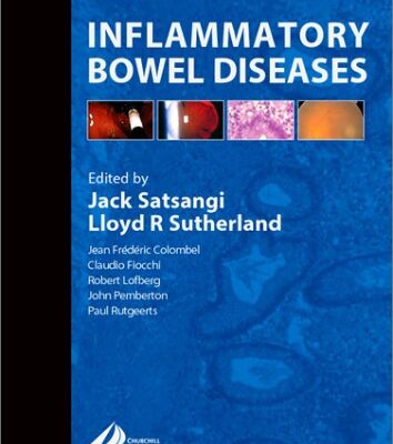 Inflammatory Bowel Diseases