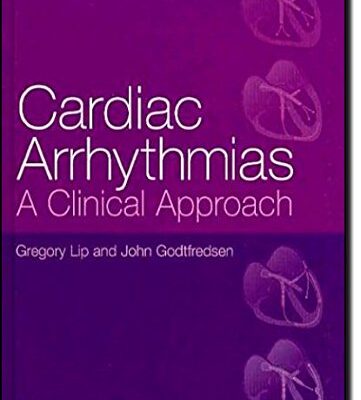 Cardiac Arrhythmias: A Clinical Approach