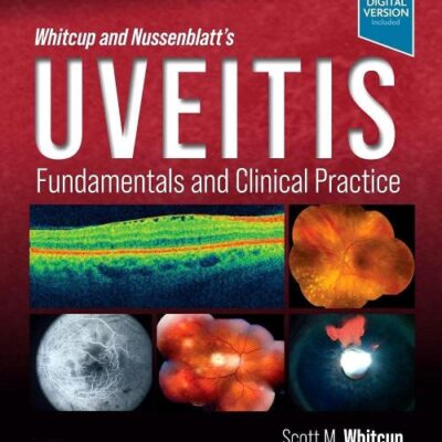 Whitcup And Nussenblatts Uveitis Fundamentals And Clinical Practice 5Ed (Hb 2022)