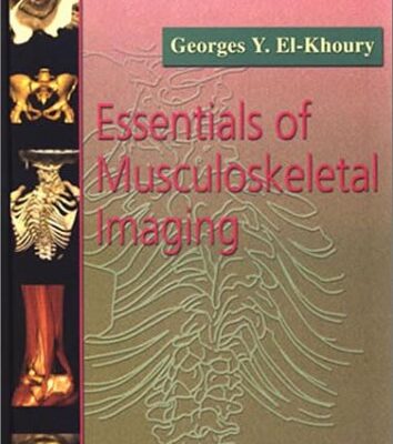 Essentials of Musculoskeletal Imaging