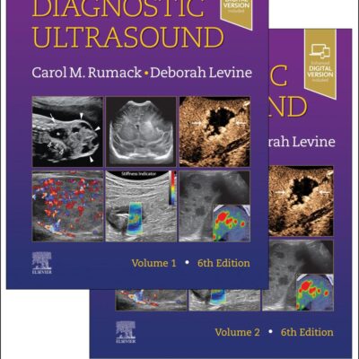 Diagnostic Ultrasound