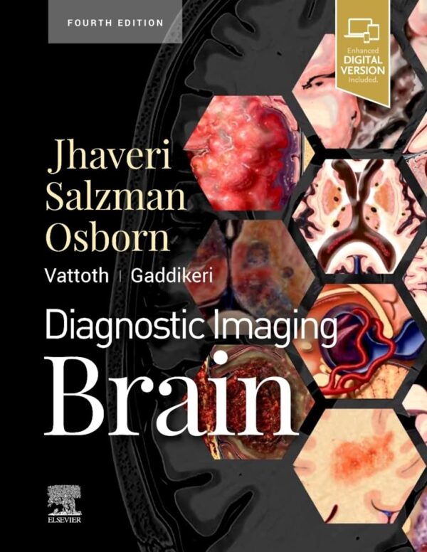 Diagnostic Imaging: Brain, 4e