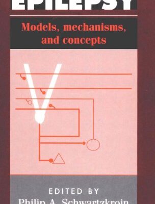 Epilepsy: Models