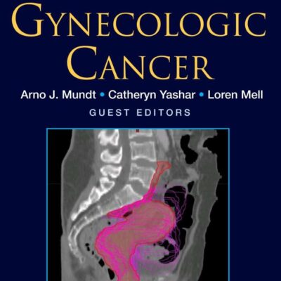 Gynecologic Cancer (2)
