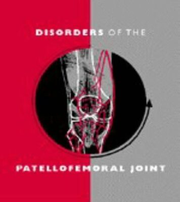 Disorders of the Patello-femoral Joint