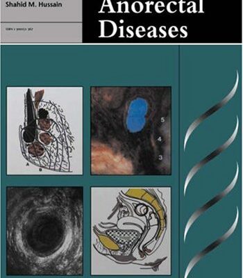 Imaging of Anorectal Diseases (Greenwich Medical Media)