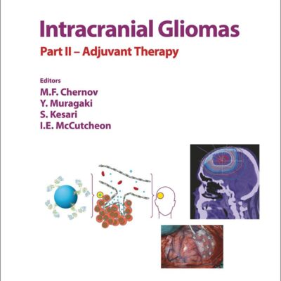 intracranial Gliomas: Part II Adjuvant Therapy (Progress in Neurological Surgery)
