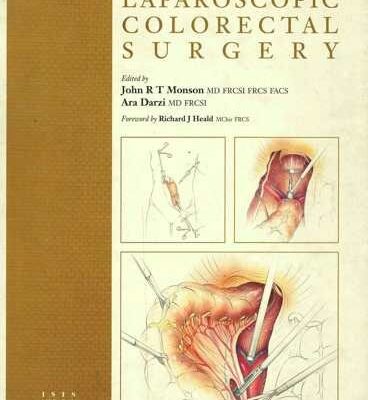 Laparoscopic Colorectal Surgery