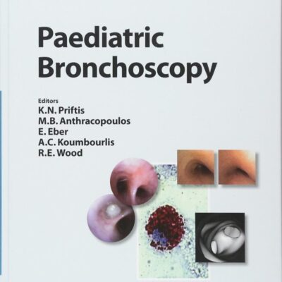 Paediatric Bronchoscopy: 38 (Progress in Respiratory Research)