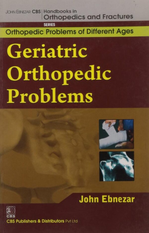 GERIATRIC ORTHOPEDIC PROBLEMS (HANDBOOKS IN ORTHOPEDICS AND FRACTURES SERIES