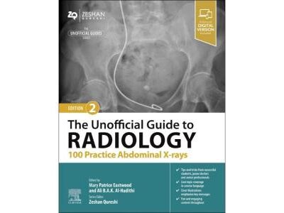 The Unofficial Guide to Radiology: 100 Practice Abdominal X-rays