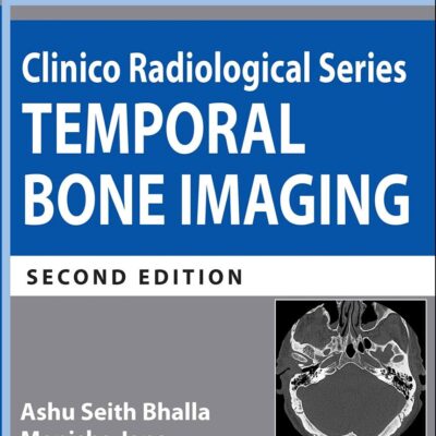 Clinico Radiological Series: Temporal Bone Imaging