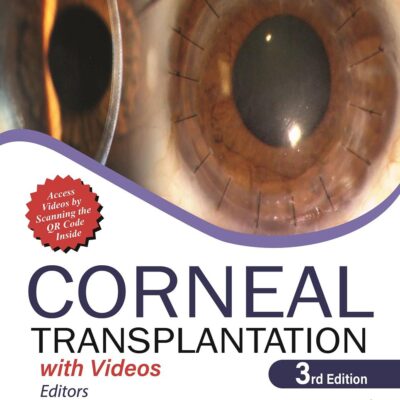 CORNEAL TRANSPLANTATION