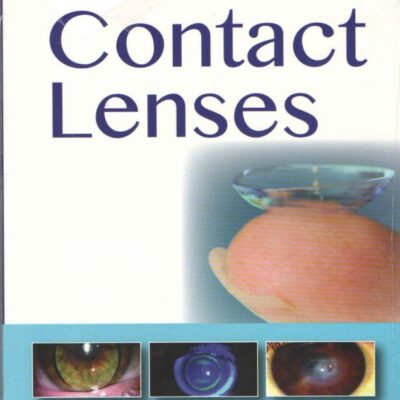 Textbook of Contact Lenses
