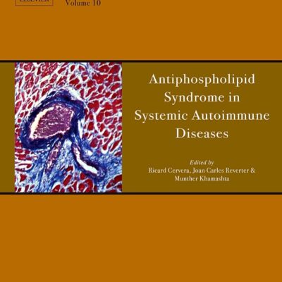 Antiphospholipid Syndrome in Systemic Autoimmune Diseases (Volume 12) (Handbook of Systemic Autoimmune Diseases