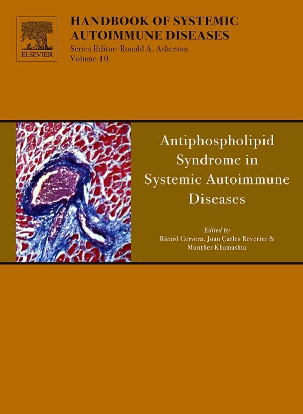 Antiphospholipid Syndrome in Systemic Autoimmune Diseases (Volume 12) (Handbook of Systemic Autoimmune Diseases