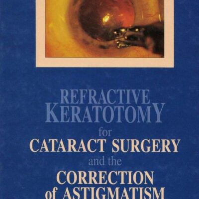 Refractive Keratotomy for Cataract Surgery and the Correction of Astigmatism