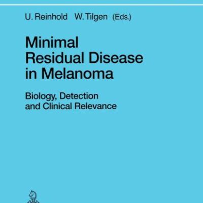 Minimal Residual Disease in Melanoma: Biology